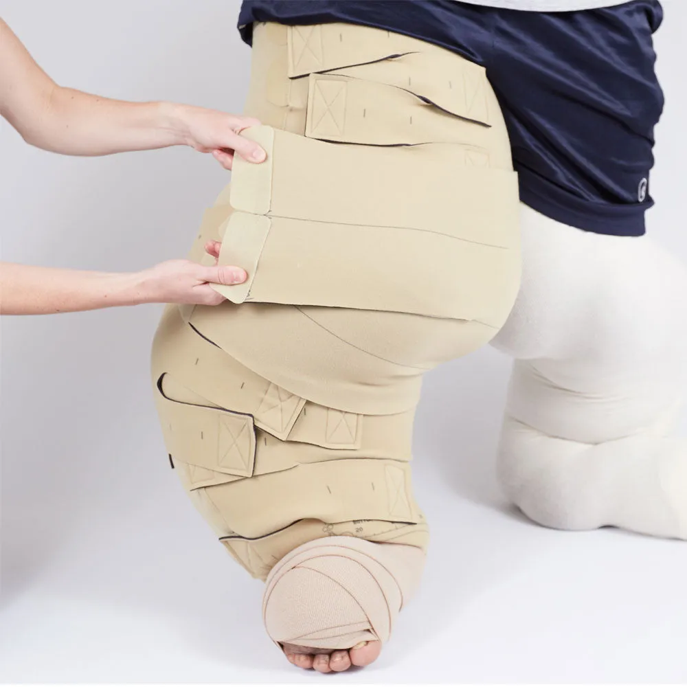 circaid reduction kit whole leg with lobe; lower leg short, upper leg short